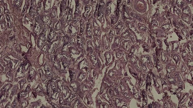 human scrotum cells under a microscope zoom in animation
