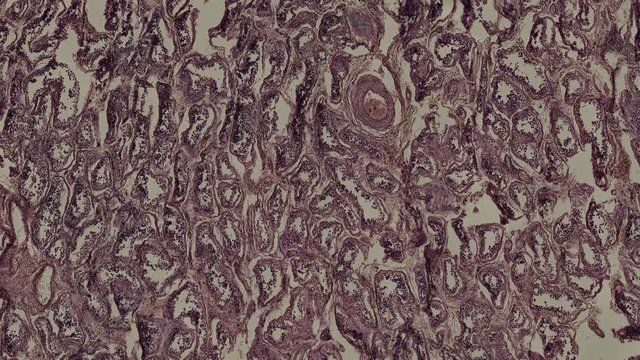 human scrotum cells under a microscope zoom in animation