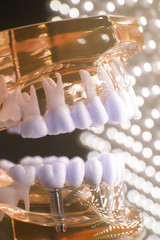 Dentists dental teeth model