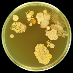 Colorful bacterial colonies on sterile agar in petri plate. Inoculation by human fingerprints on...