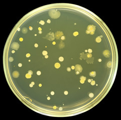 Colonies of bacteria from air on a petri dish (agar plate) isolated on black background. Nutrient...