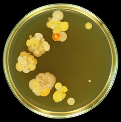 Colorful bacterial colonies like flowers. Human fingerprints on meat-peptone agar in petri dish....