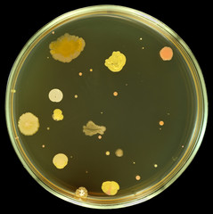 Different color, size and type colonies of bacteria from public area air on a petri dish (agar plate) isolated on a black  background by pen tool. Nutrient agar (meat-peptone) media used.
