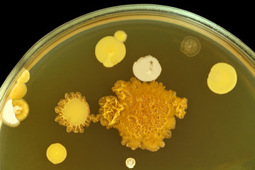 Colorful bacterial colonies close up. Different microbes  on meat-peptone agar in petri dish....