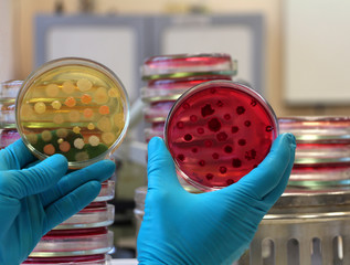Doctor holding two different petri plates and compares bacterial colonies. Meat-peptone agar on the...