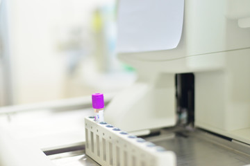 Abnormal malignant cells specimen pleural fluid.