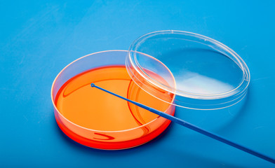 Petri dishes with blood agar