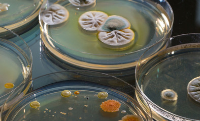 Petri dish with colonies of bacteria and fungi