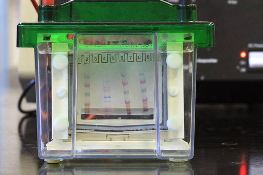 Different molecular weigth protein band being separated by gel electrosphoresis