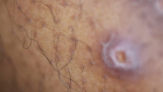 Close up of Human Skin Texture 
