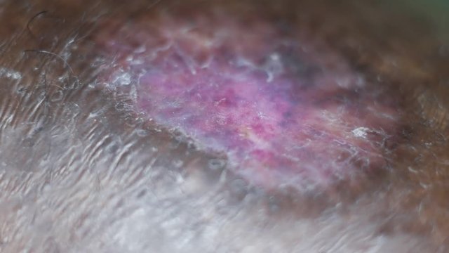 Close up of Human Skin Texture 
