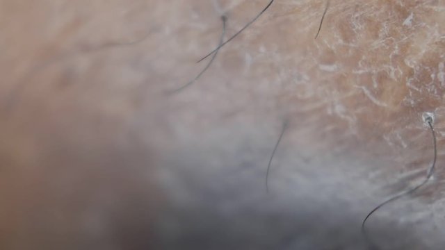 Close up of Human Skin Texture 
