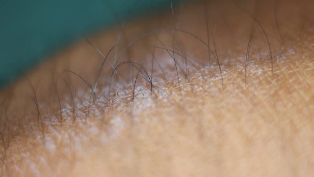 Close up of Human Skin Texture 
