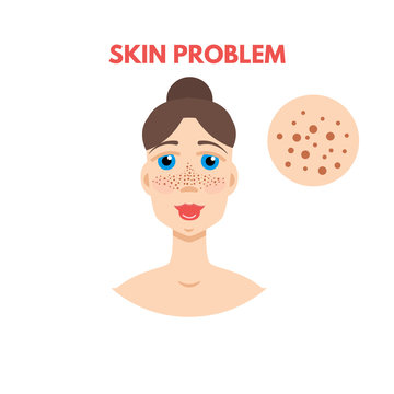 Woman with skin problem. Vector illustration