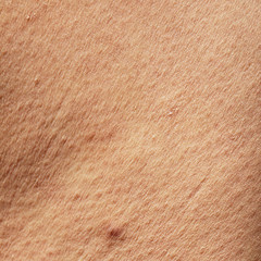human skin texture