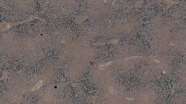 human liver cells under a microscope zoom in animation