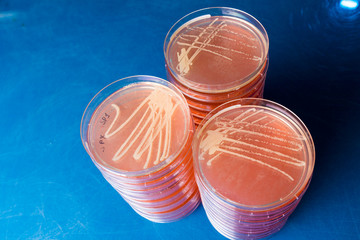 Petri dishes with biological samples  for medical and biological analyzes