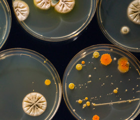 Petri dish with colonies of bacteria and fungi