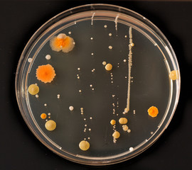 Petri dishes with colonies of microbes