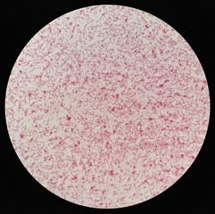 Smear of gram negative bacilli bacteria under 100X light microscope (Selective focus).