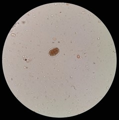 Hookworm egg in stool examination, under 40X light microscope.