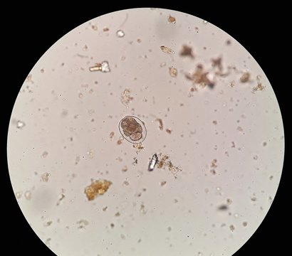 Hookworm egg in stool examination, under 40X light microscope.