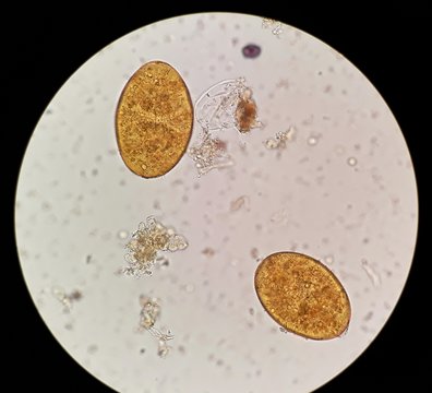 Fasiola species eggs in stool examination, under 40X light microscope, selective focus.