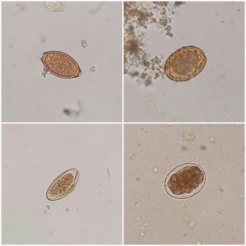 The parasites in stool. The upper left is Trichuris trichiura egg, the upper right is Ascaris spp. egg, the lower left is Enterobius spp. egg and the lower right is Hookworm egg (Selective focus).