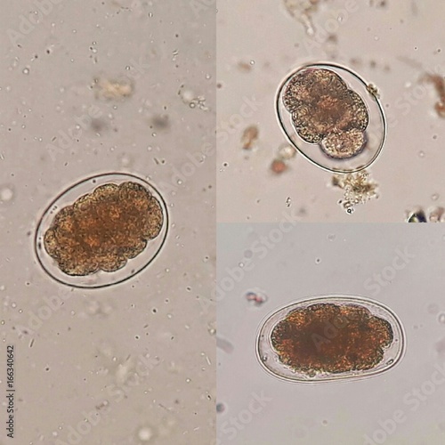 "Three patterns of Hookworm eggs; the parasite in stool, under 40X