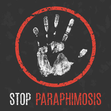 Vector illustration. The medical diagnosis. Stop paraphimosis.