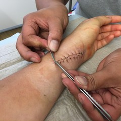 F&auml;den nach einer Operation ziehen