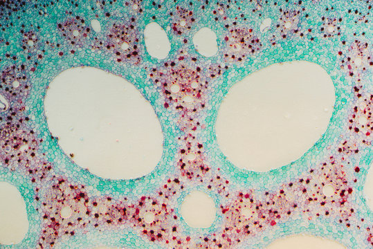 plant cells micrograph