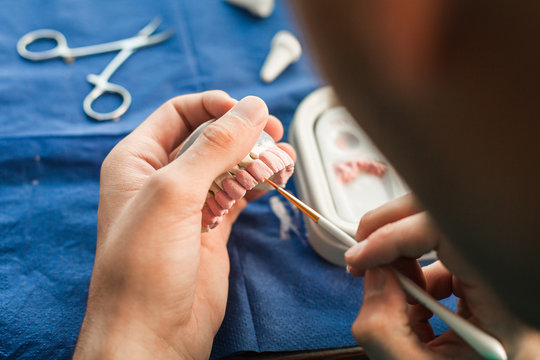 CLose up of orthodontist covering dentures with ceramic .