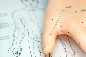 Akupunkturnadel in Handmodell mit Lehrbuch