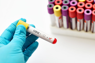 Blood sample positive with H1N1 influenza virus
