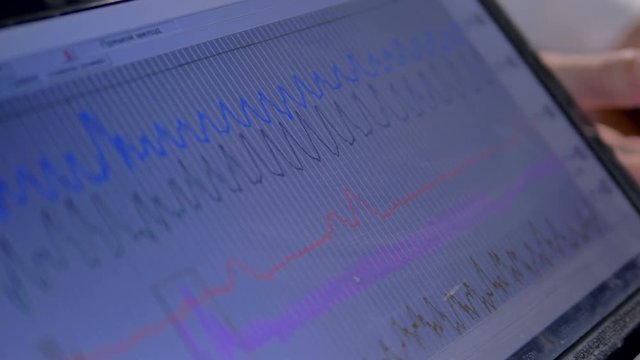 Closeup of a polygraph data laptop screen. 