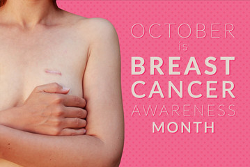 Caucasian woman with breast cancer scar on the pink background isolated with text October is Breast cancer awareness month - 166529043