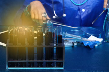 Blood Glass Tube Lab Test with tools equipment and Fashion hand experiment research