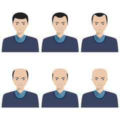 Hair loss stages and types of baldness.