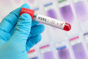 Fototapeta premium Blood sample positive with H1N1 influenza virus 