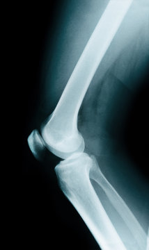 Knee bone anatomy