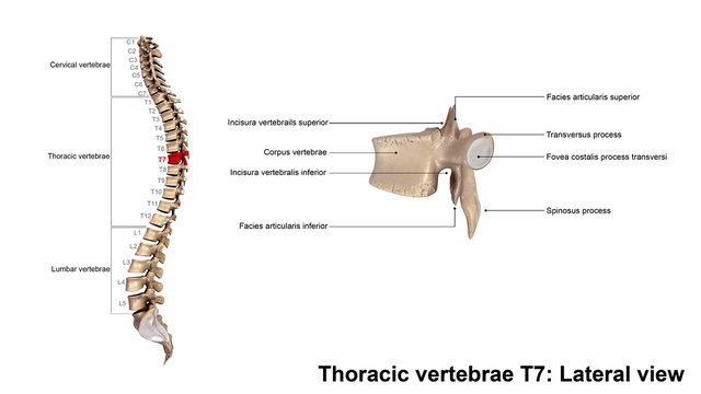 Thoracic vertebrae T7_Lateral view