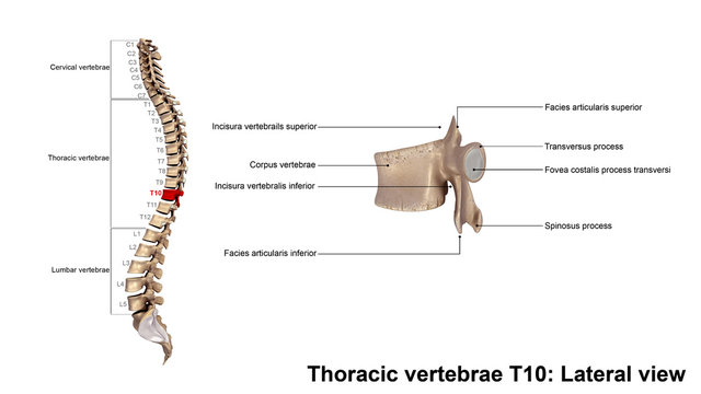 Thoracic vertebrae T10_Lateral view