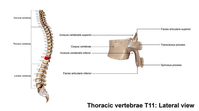 Thoracic vertebrae T11_Lateral view