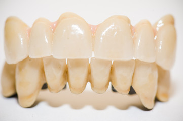 denture