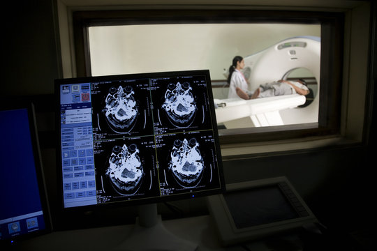 MRI results on a computer 