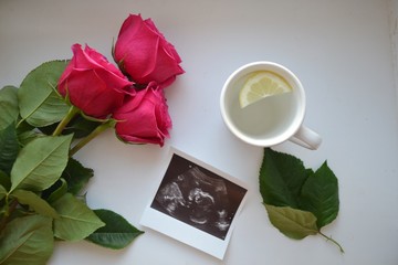 
Ultrasound. Child. A happy event.