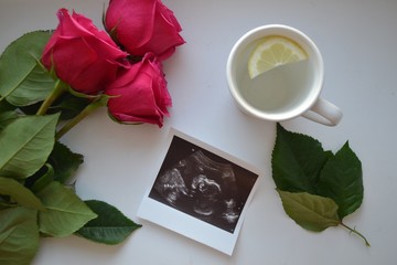 
Ultrasound. Child. A happy event.