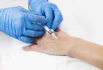 Mesotherapy process on a female hand in clinic 