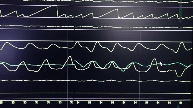 Black monitor screen  with moving lines.